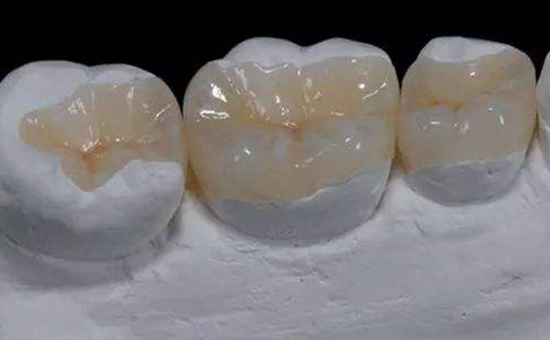 吳江補牙洞價格