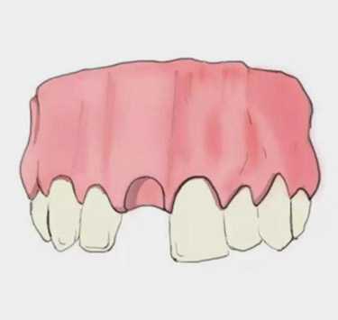 口腔情況