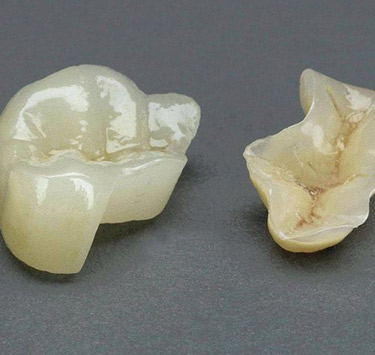 缺損修復
