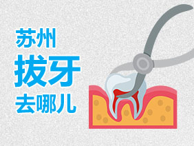 蘇州拔牙去哪
