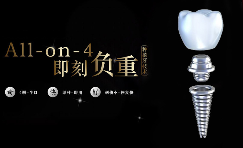 AllOnFour即刻種植技術
